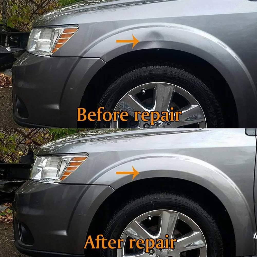 PDR Car Dent Repair Kit – Paintless Dent Removal Tool